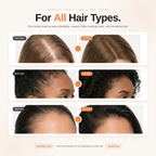 Marley's Hair Growth Serum